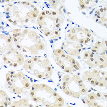 Anti-THOC1 Polyclonal Antibody (CAB8179)