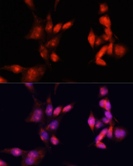 Anti-IRAK1 Antibody (CAB12624)