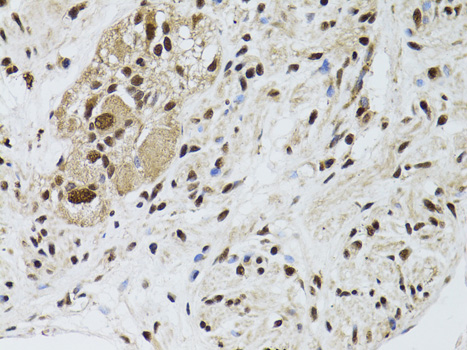 Anti-LKB1 Antibody [KO Validated] (CAB2122)