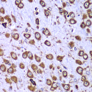 Anti-RPS10 Antibody (CAB6056)