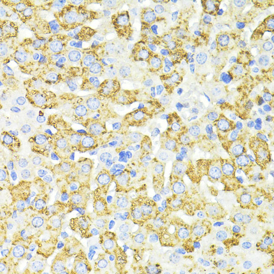 Anti-SQSTM1 / p62 Antibody [KO Validated] (CAB11483)