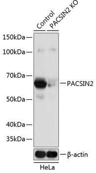 Anti-PACSIN2 Antibody [KO Validated] (CAB19941)