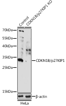 Anti-CDKN1B/p27KIP1 Antibody [KO Validated] (CAB16633)