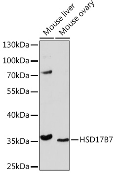 Anti-HSD17B7 Antibody (CAB17157)