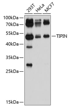 Anti-TIPIN Antibody (CAB10344)