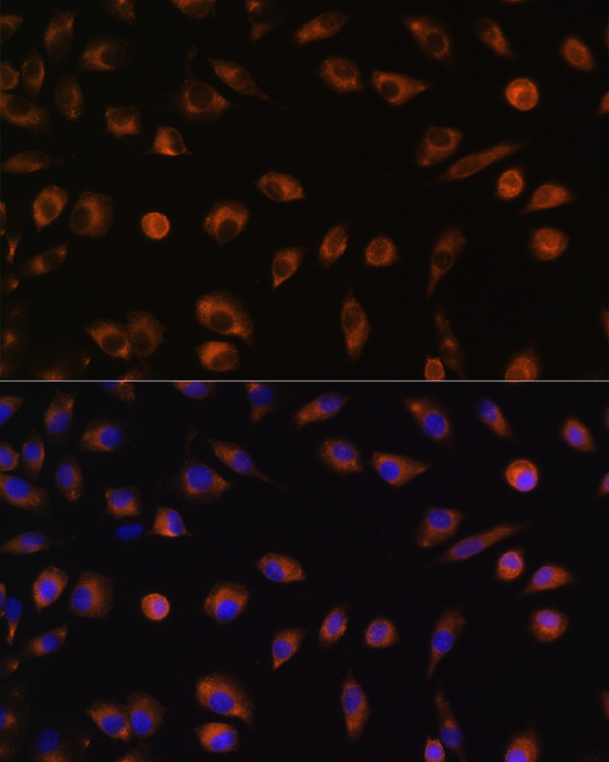 Anti-GJA1 Antibody (CAB11752)