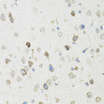 Anti-VASH1 Antibody (CAB12569)