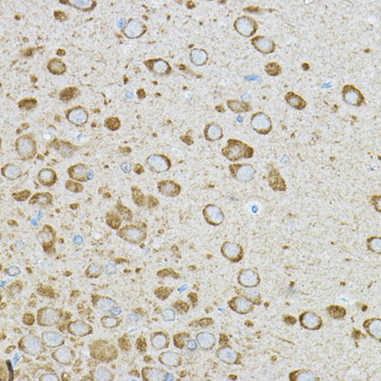 Anti-IRAK4 Antibody (CAB6208)