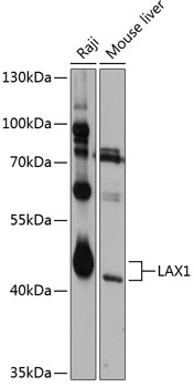 Anti-LAX1 Antibody (CAB12218)