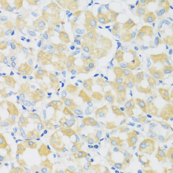 Anti-C1GALT1 Antibody (CAB12865)