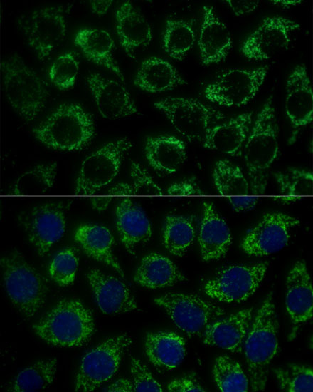 Anti-MTIF2 Antibody (CAB16402)