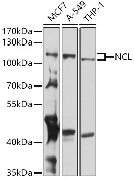 Anti-NCL Antibody (CAB5904)