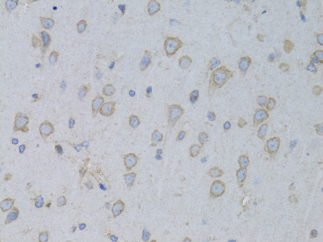 Anti-GARS Antibody (CAB5435)