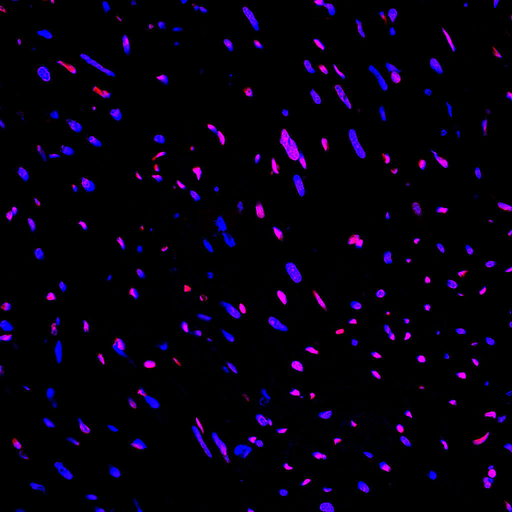 Paraffin embedded rat heart was treated with DNase I to fragment the DNA. DNA strand breaks showed intense fluorescent staining in DNase I treated sample (red). The cells were counterstained with DAPI (blue).This photo was taken by confocal microscope.