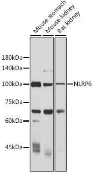 Anti-NLRP6 Antibody (CAB15628)