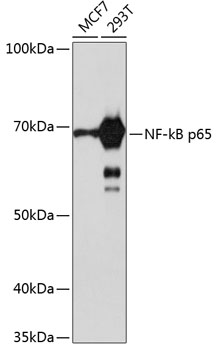 Anti-NF-kB p65 Antibody [KO Validated] (CAB19653)