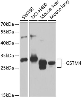 Anti-GSTM4 Antibody (CAB7434)