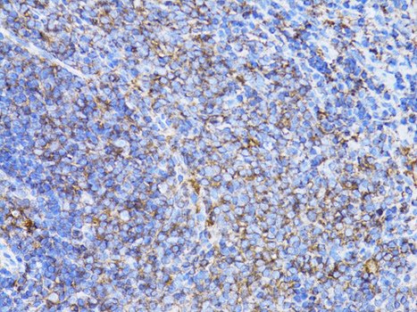 Anti-Beta Actin Mouse Monoclonal Antibody (CABC004)