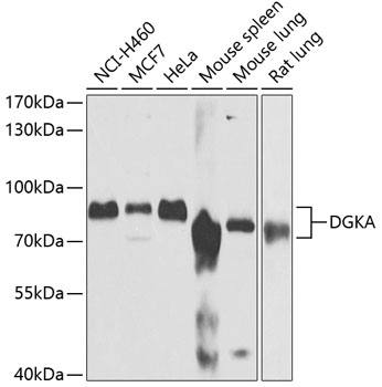 Anti-DGKA Antibody (CAB6896)