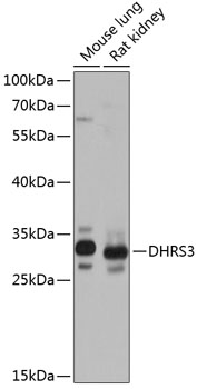 Anti-DHRS3 Antibody (CAB14172)