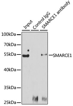 Anti-SMARCE1 Antibody [KO Validated] (CAB13353)