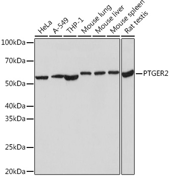 Anti-PTGER2 Antibody (CAB9053)