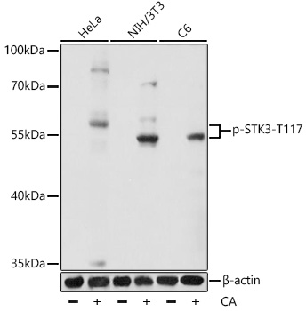 Anti-Phospho-STK3-T117 Antibody (CABP0934)