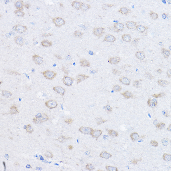 Anti-UBE4A Antibody (CAB3354)