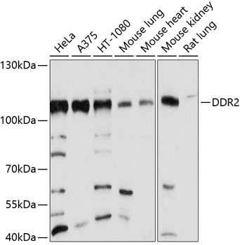 Anti-DDR2 Antibody (CAB10060)