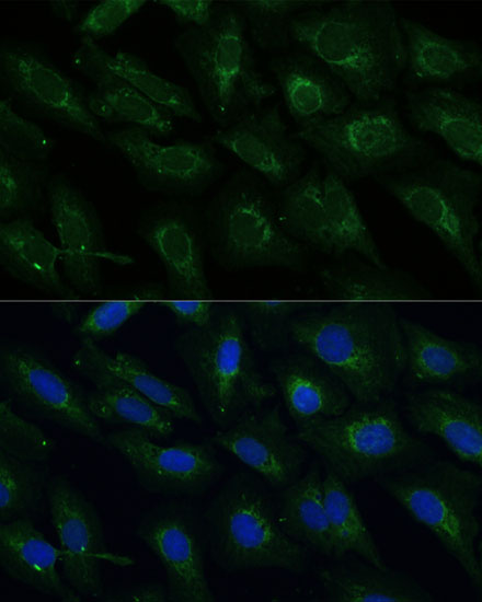 Anti-NDUFB4 Antibody [KO Validated] (CAB13820)