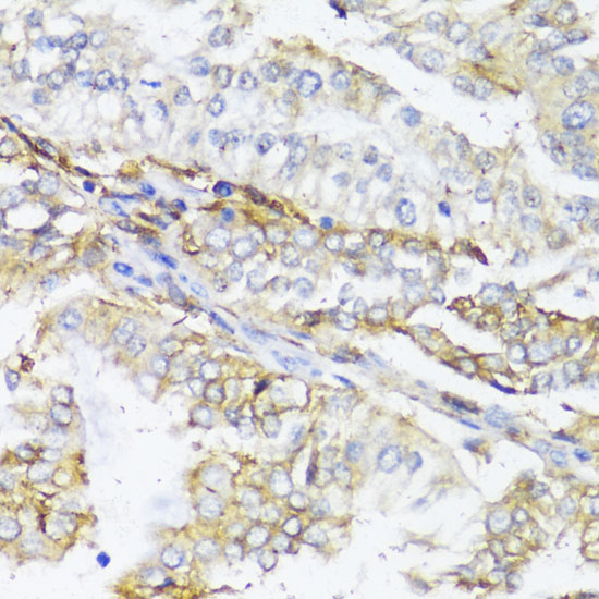 Anti-HLA-DPB1 Antibody (CAB13312)