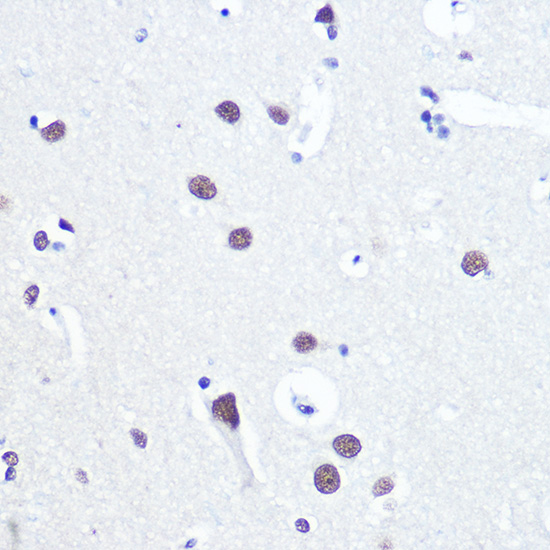 Anti-53BP1 Antibody (CAB5757)