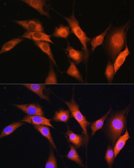 Anti-ARCN1 Antibody (CAB14993)