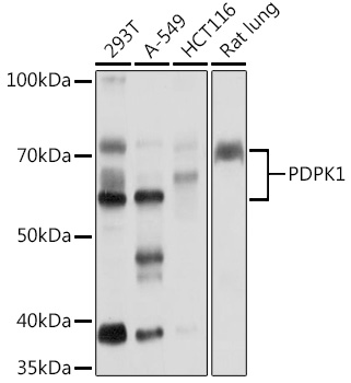 Anti-PDPK1 Antibody (CAB1665)