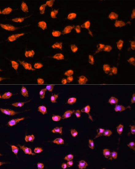 Anti-PRKCB Antibody (CAB5845)