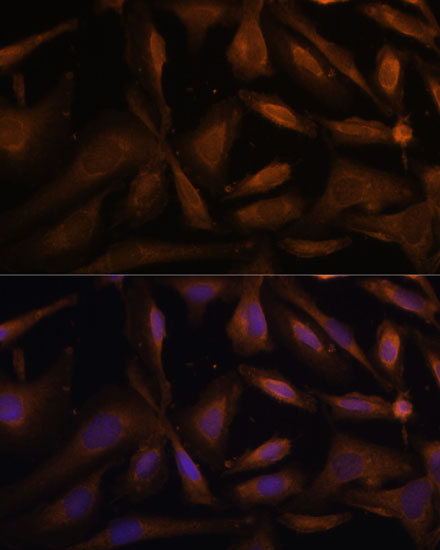 Anti-UFC1 Antibody (CAB13192)