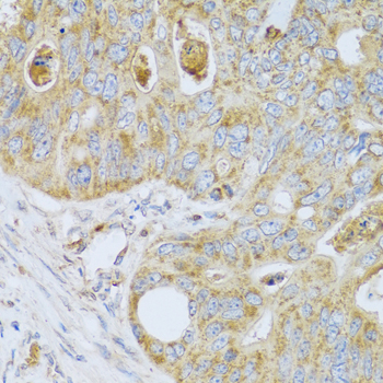 Anti-PSG1 Antibody (CAB6399)