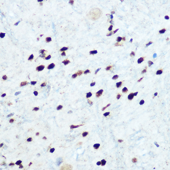 Anti-Phospho-NFKBIA-S32 Antibody (CABP0731)