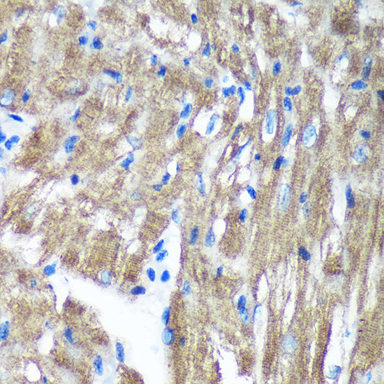 Anti-TIMMDC1 Antibody (CAB15839)