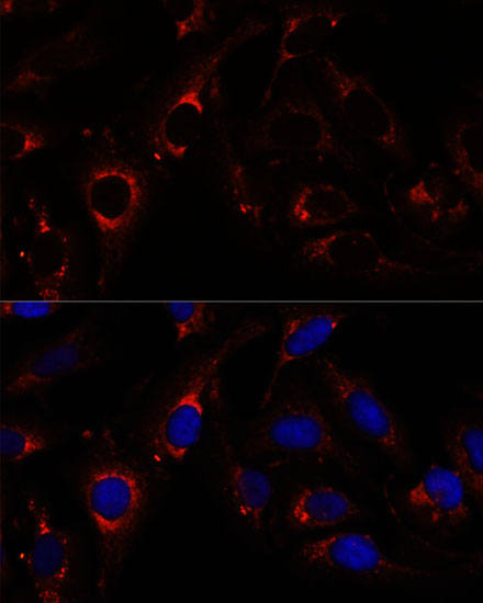 Anti-RNF112 Antibody (CAB15333)