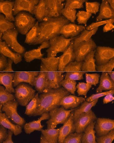 Anti-SQSTM1 / p62 Antibody (CAB7758)