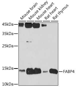 Anti-FABP4 Antibody (CAB0232)