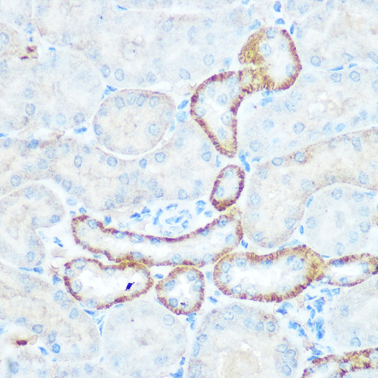 Anti-NDUFV1 Antibody (CAB13333)