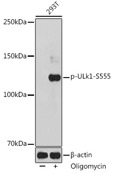 Anti-Phospho-ULk1-S555 pAb (CABP0760)