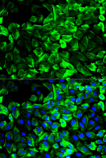 Anti-TPM1 Antibody (CAB1157)