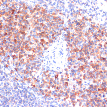 Anti-Phospho-RELA-S311 Antibody (CABP0445)