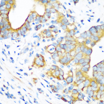 Anti-MTCO2 Antibody (CAB11522)