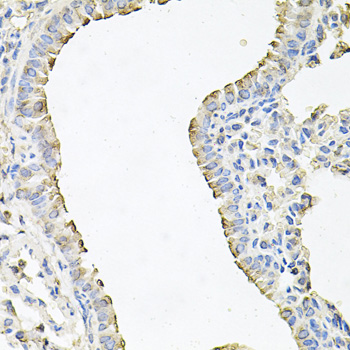 Anti-SCNN1G Antibody (CAB6126)