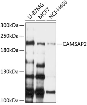 Anti-CAMSAP2 Polyclonal Antibody (CAB9315)