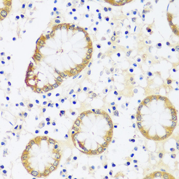 Anti-CAMK1 Antibody (CAB14495)